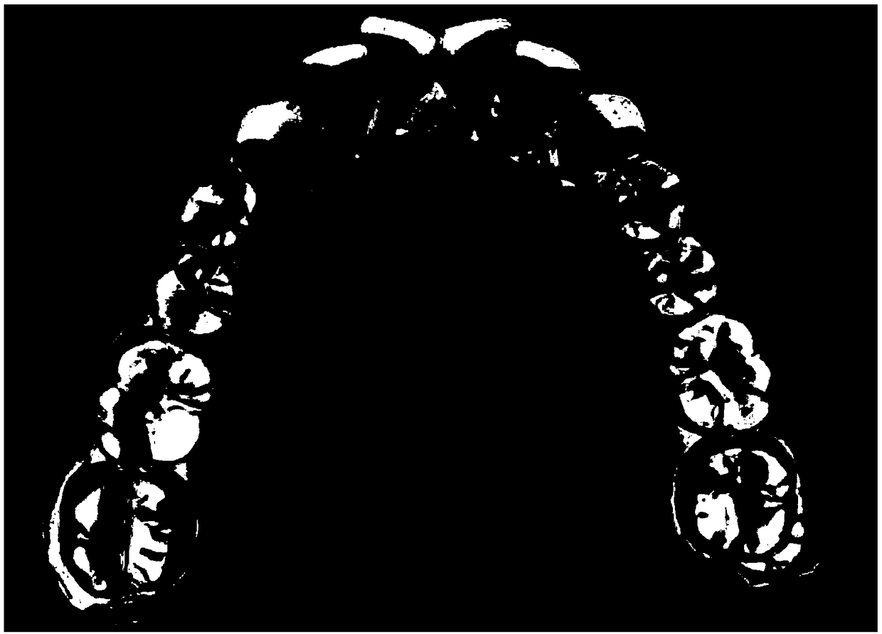 Method for segmenting three-dimensional tooth grid data based on harmonic field algorithm