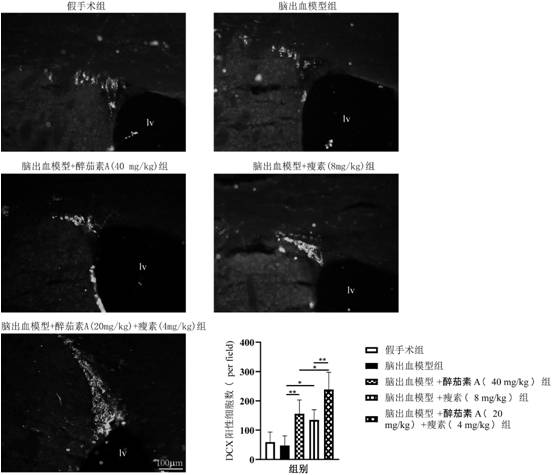 Composition of withaferin A and leptin and application of composition to preparation of medicine for preventing and/or treating hemorrhagic stroke