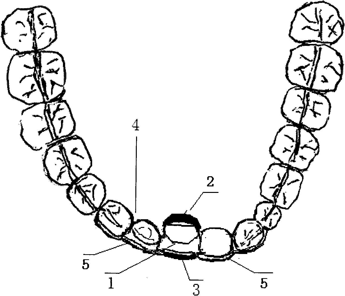 Tooth magnetic force correction method
