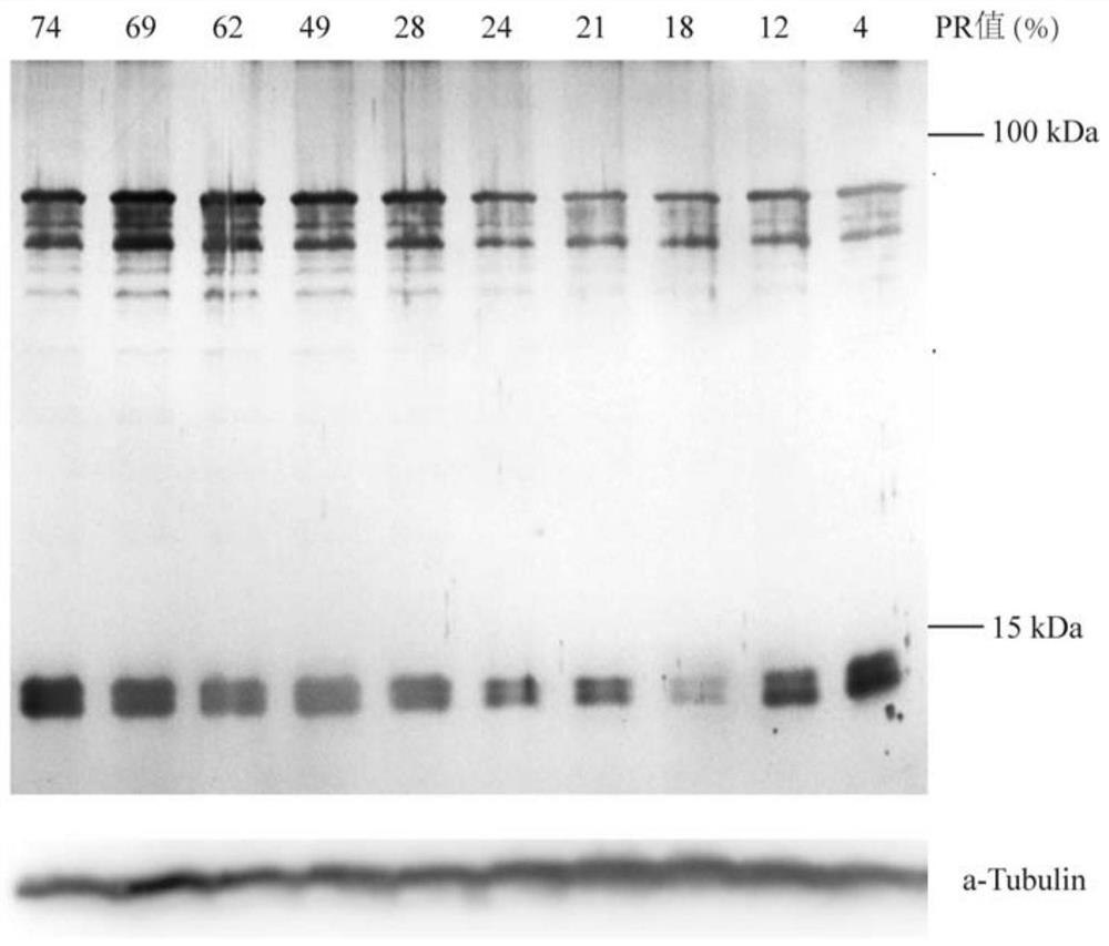 Marker protein related to asthenospermia and application of marker protein