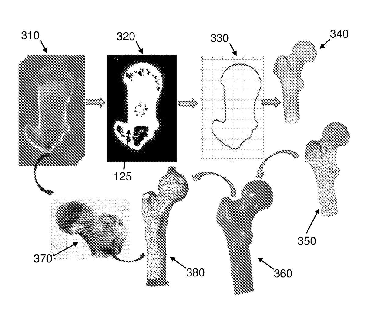 Automated patient-specific method for biomechanical analysis of bone