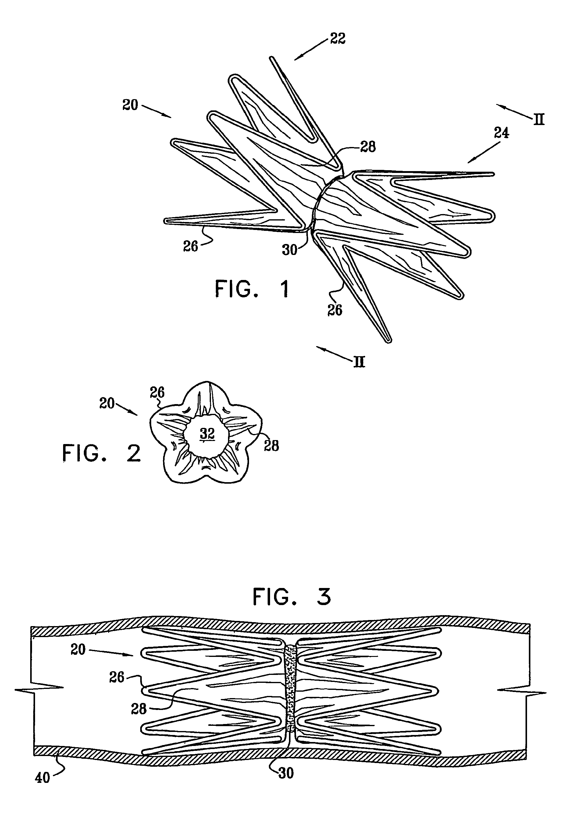 Vascular implant