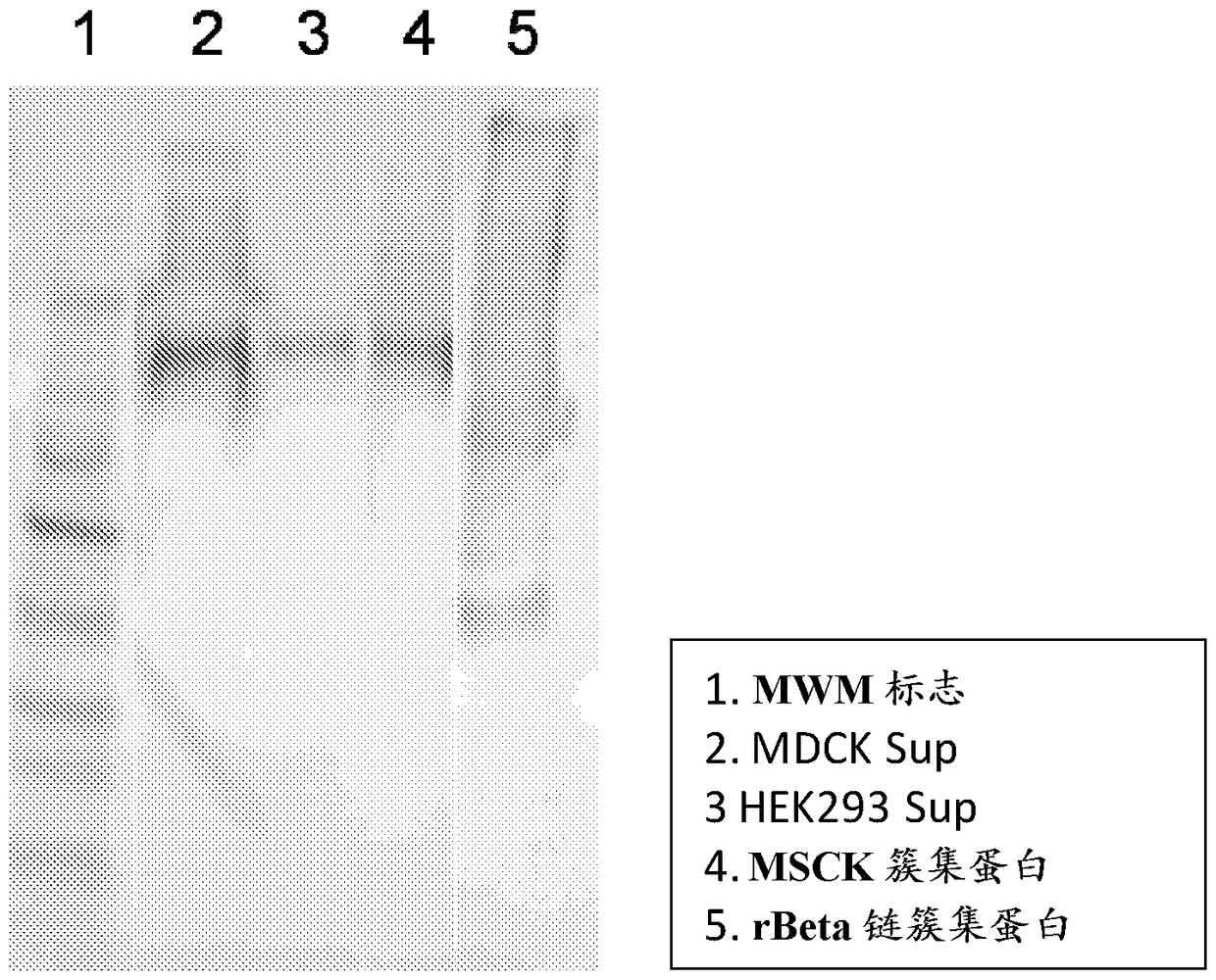 Specific detection of clusterin isoforms