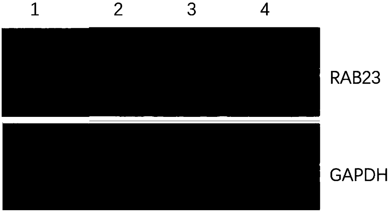 Epidermal stem cell RAB23 gene knockout through CRISPR-Cas (clustered regularly interspaced short palindromic repeats-CRISPR-associated proteins) system