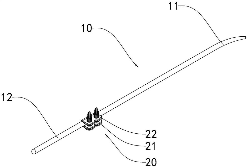 Intramedullary locking needle with terminal extramedullary locking function