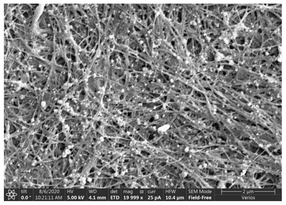 Preparation method of photo-thermal sensitive composite bacterial cellulose antibacterial dressing