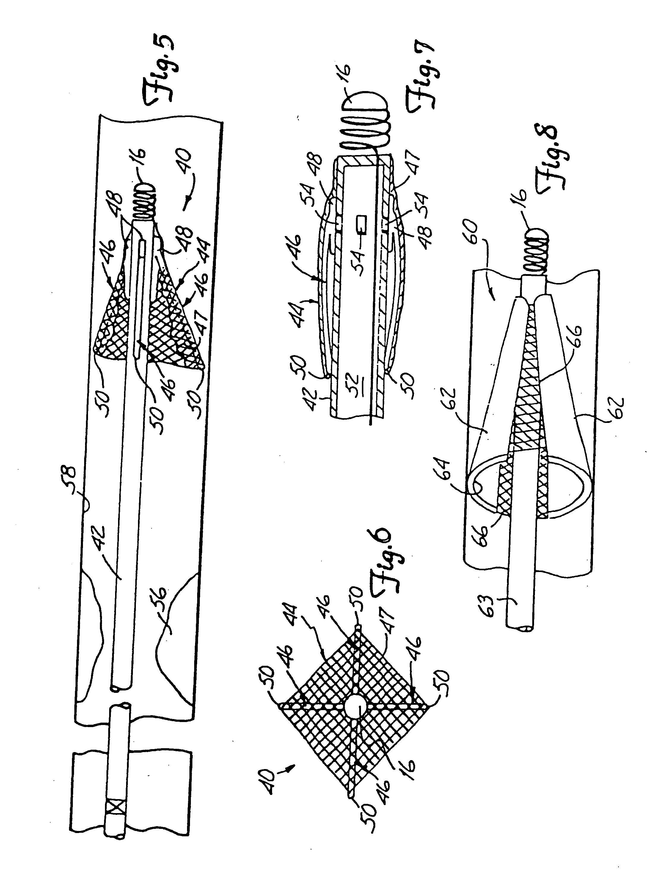 Distal protection device and method