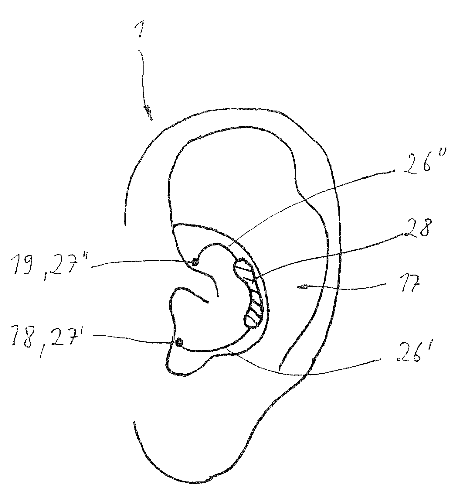 Device for applying a transcutaneous stimulus or for transcutaneous measuring of a parameter