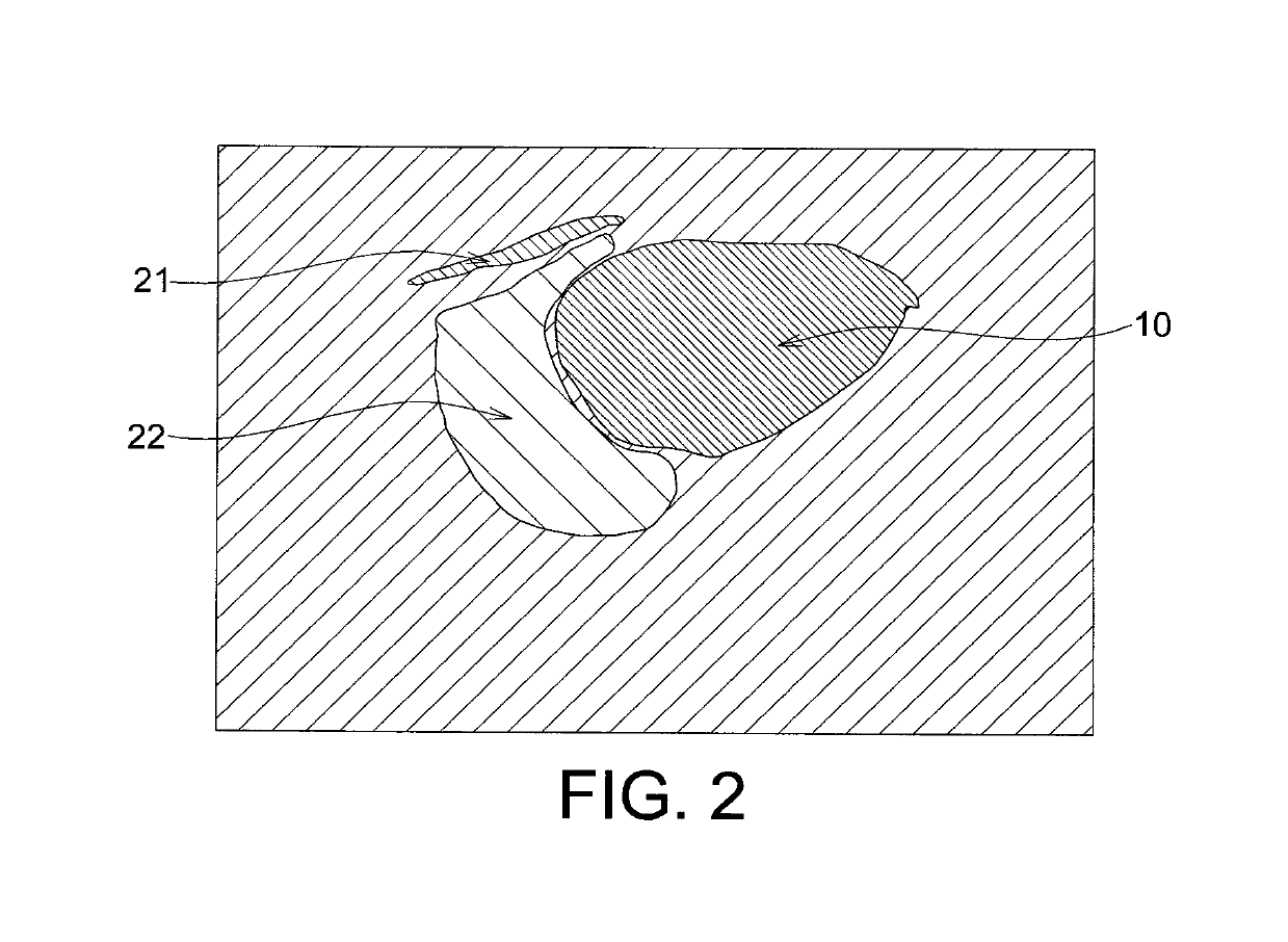 Echogenicity quantification method and calibration method for ultrasonic device using echogenicity index