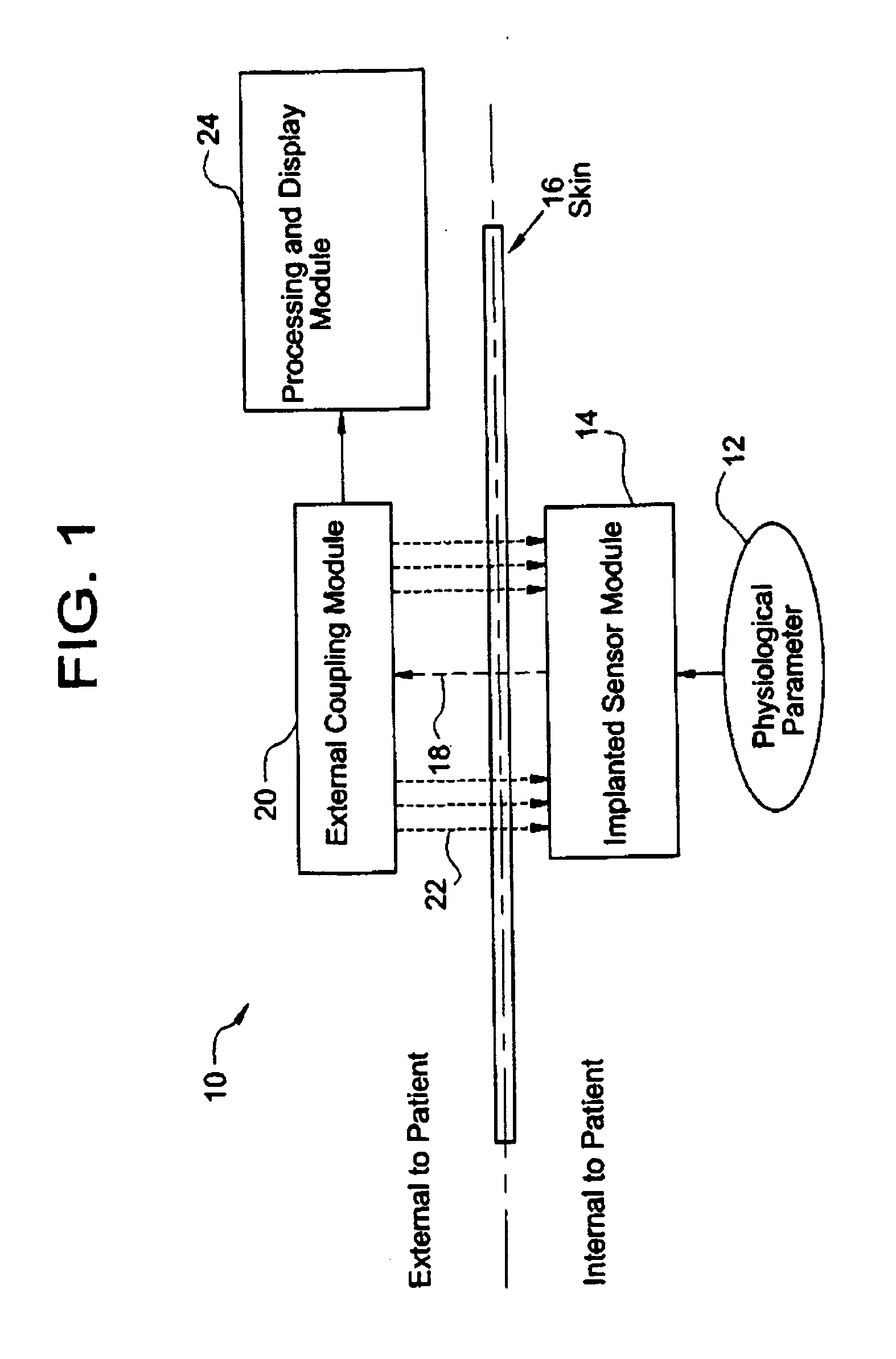 System for transcutaneous monitoring of intracranial pressure