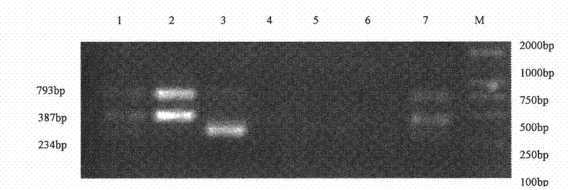 Triple Polymerase Chain Reaction(PCR)kit for identifying endogenous and exogenous avian leukosis viruses