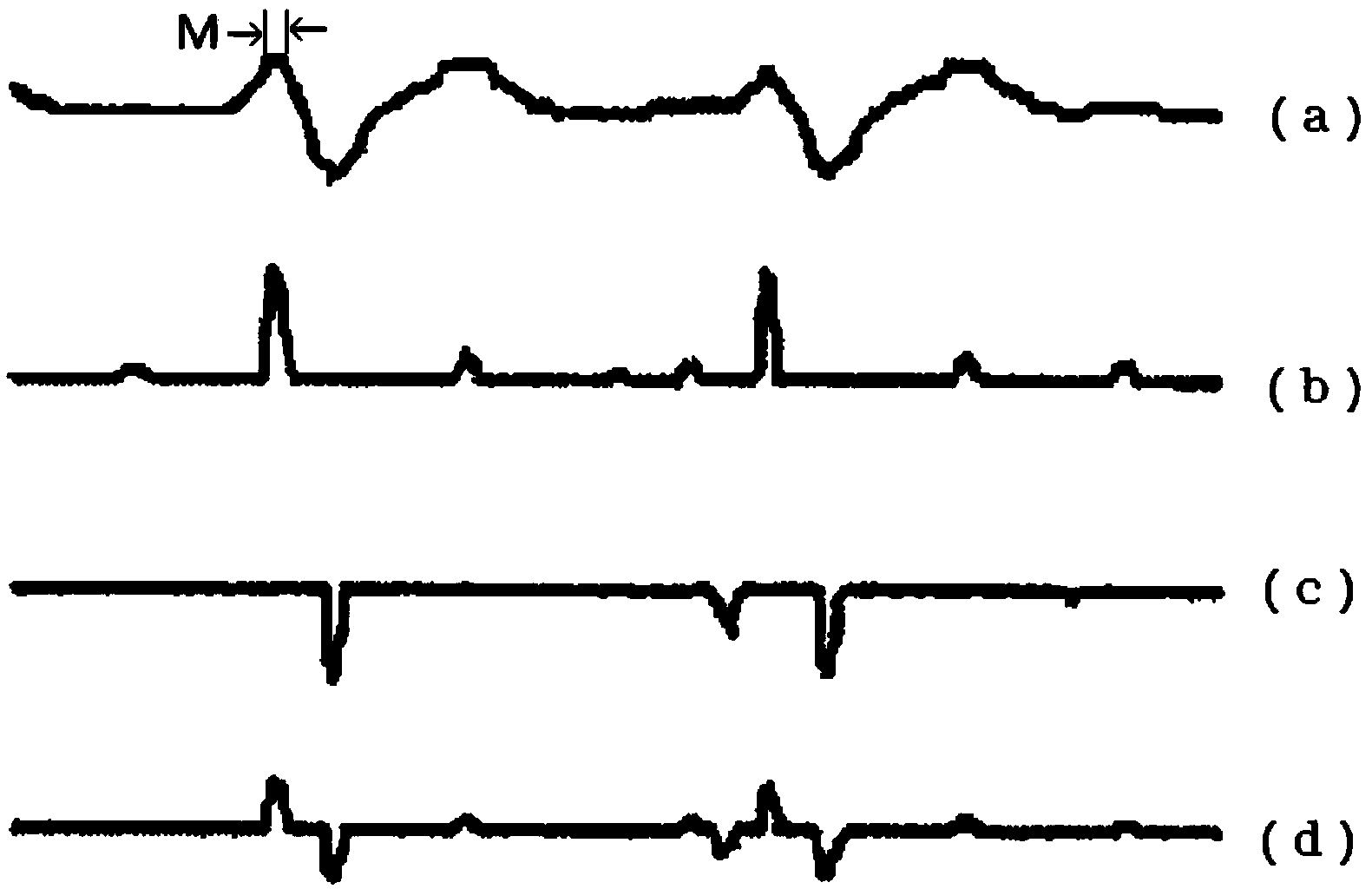 Method and device for detecting P-wave and T-wave in electrocardiogram (ECG) signal
