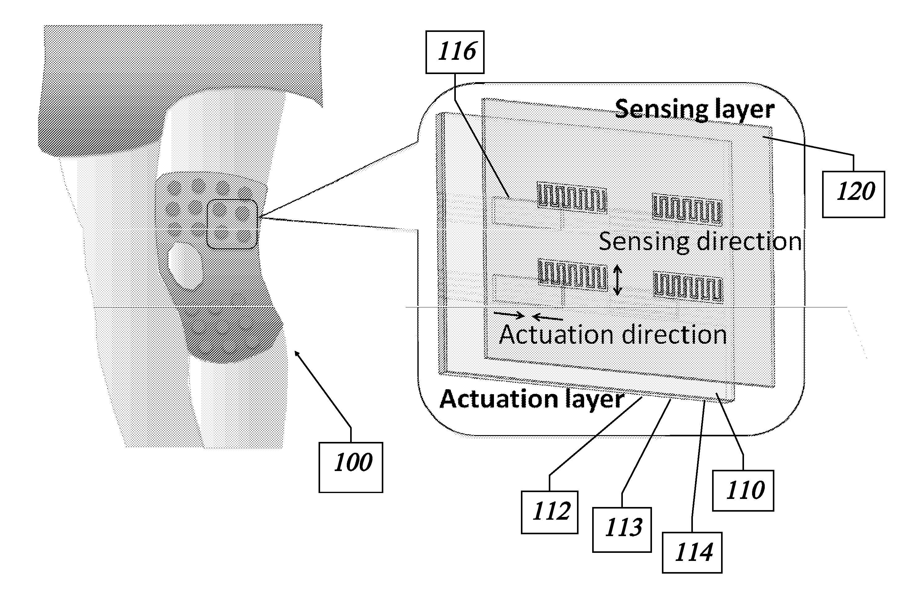 Actively controlled wearable orthotic devices and active modular elastomer sleeve for wearable orthotic devices