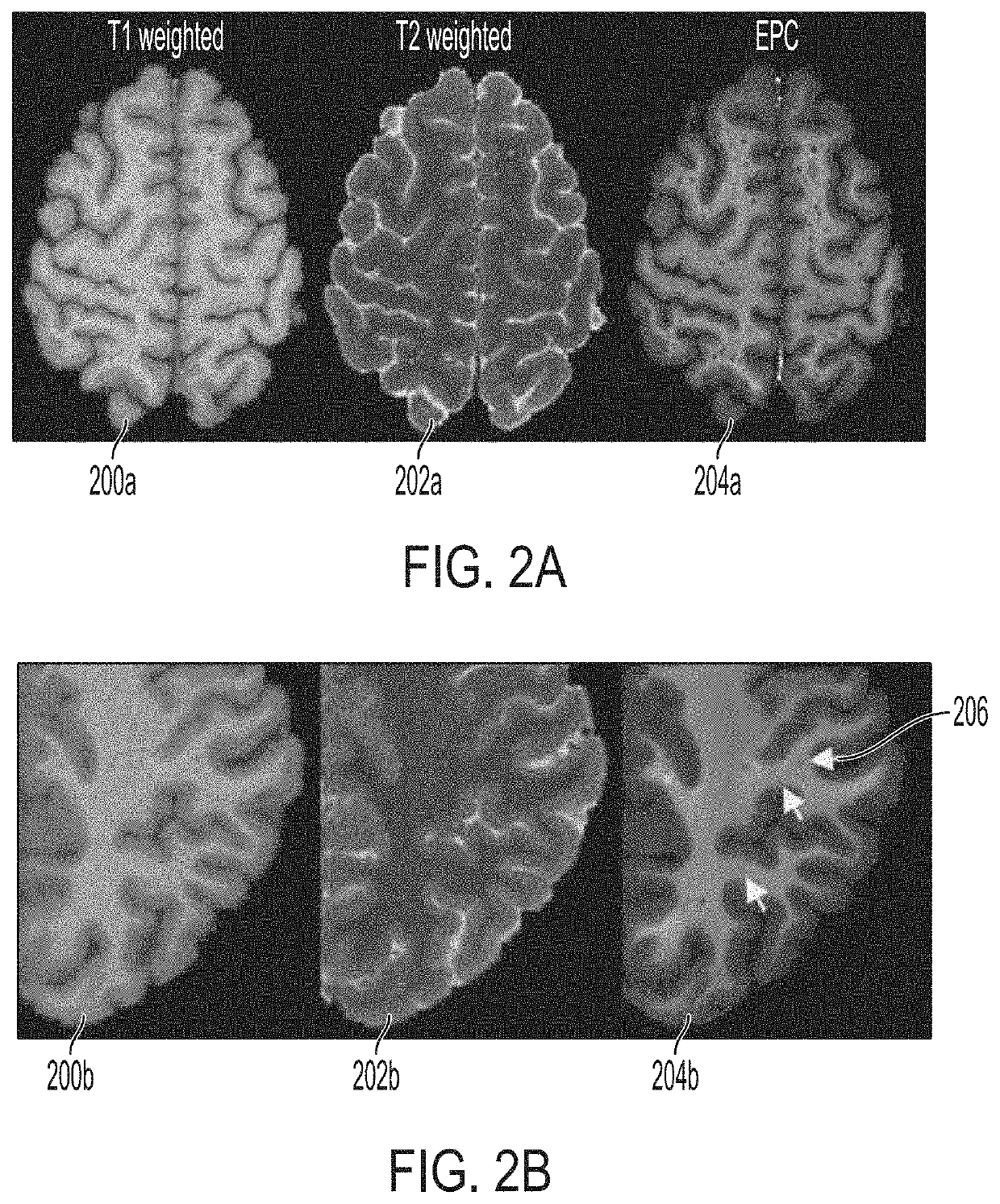 Mapping brain perivascular spaces