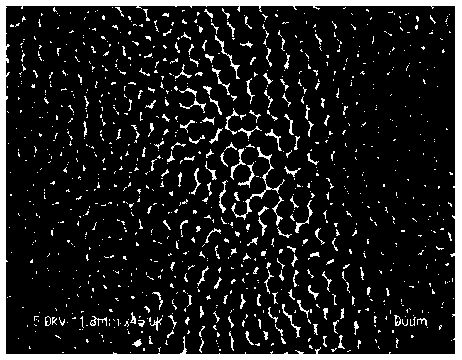 Surface treatment metal, treatment method thereof, metal resin composite body and preparing method thereof