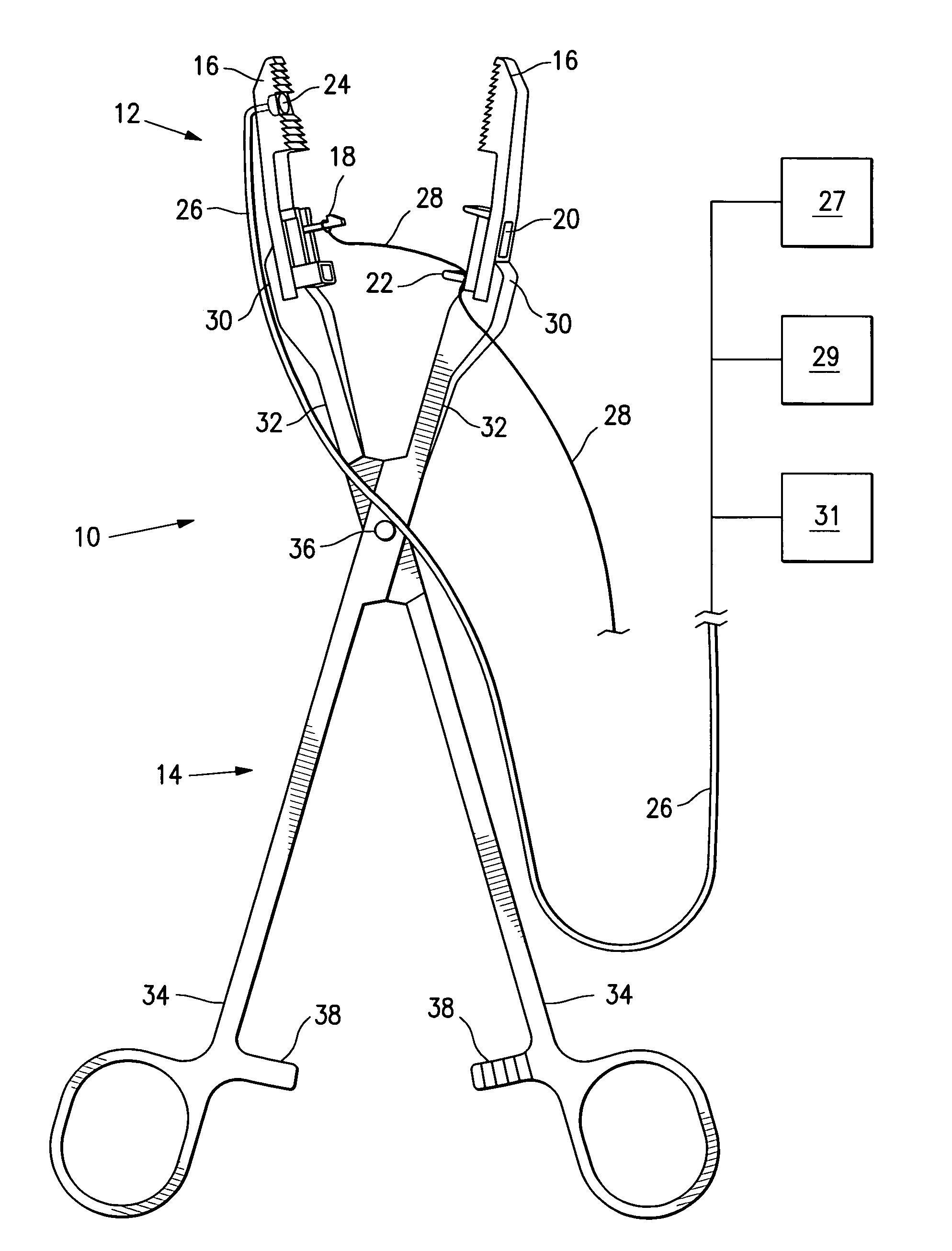 Method and apparatus for the detection and ligation of uterine arteries