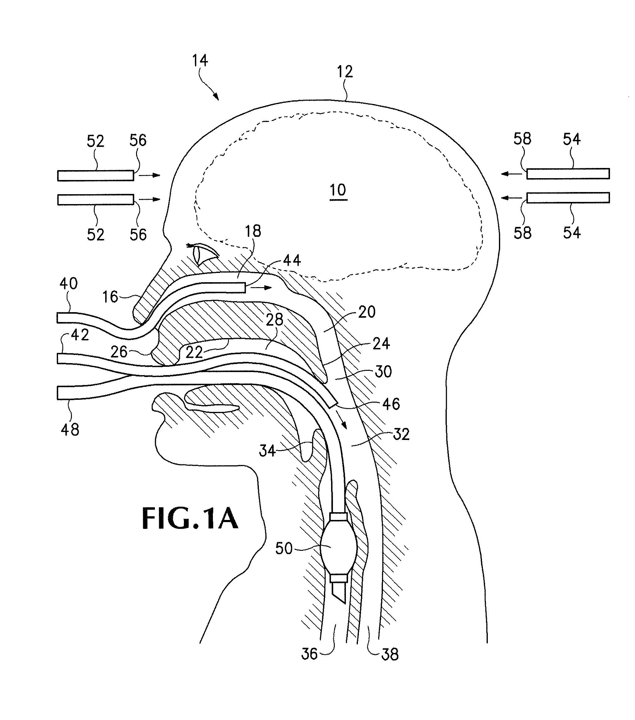 Non-invasive systems, devices, and methods for selective brain cooling