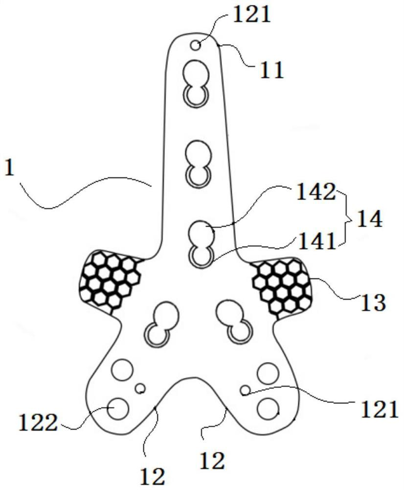 Locking plate for distal tibia