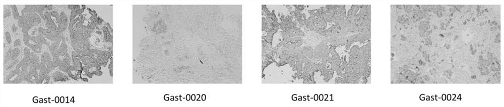 CAR vector of specific high-expression protein MSLN for targeing gastric cancer cell as well as construction method and application thereof