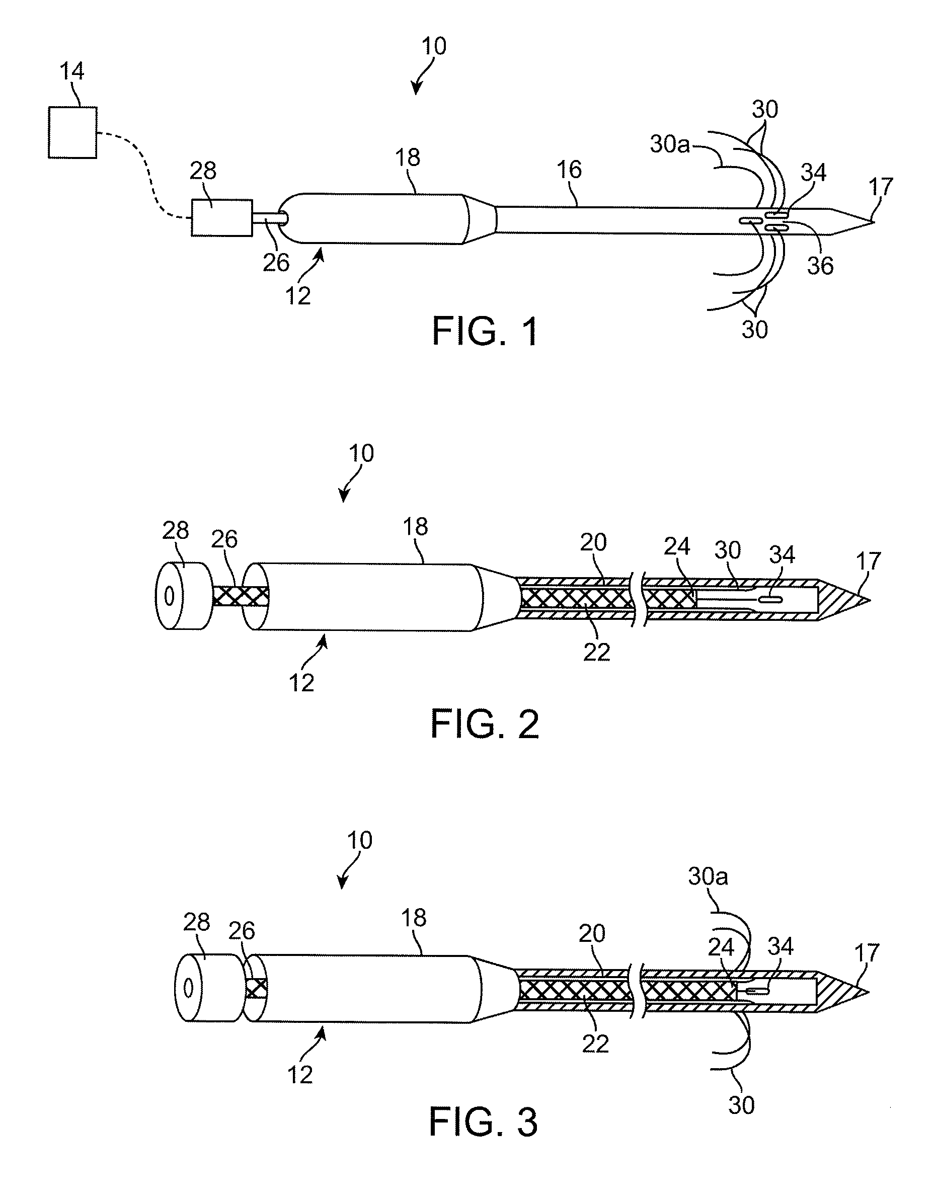 Radiofrequency ablation device