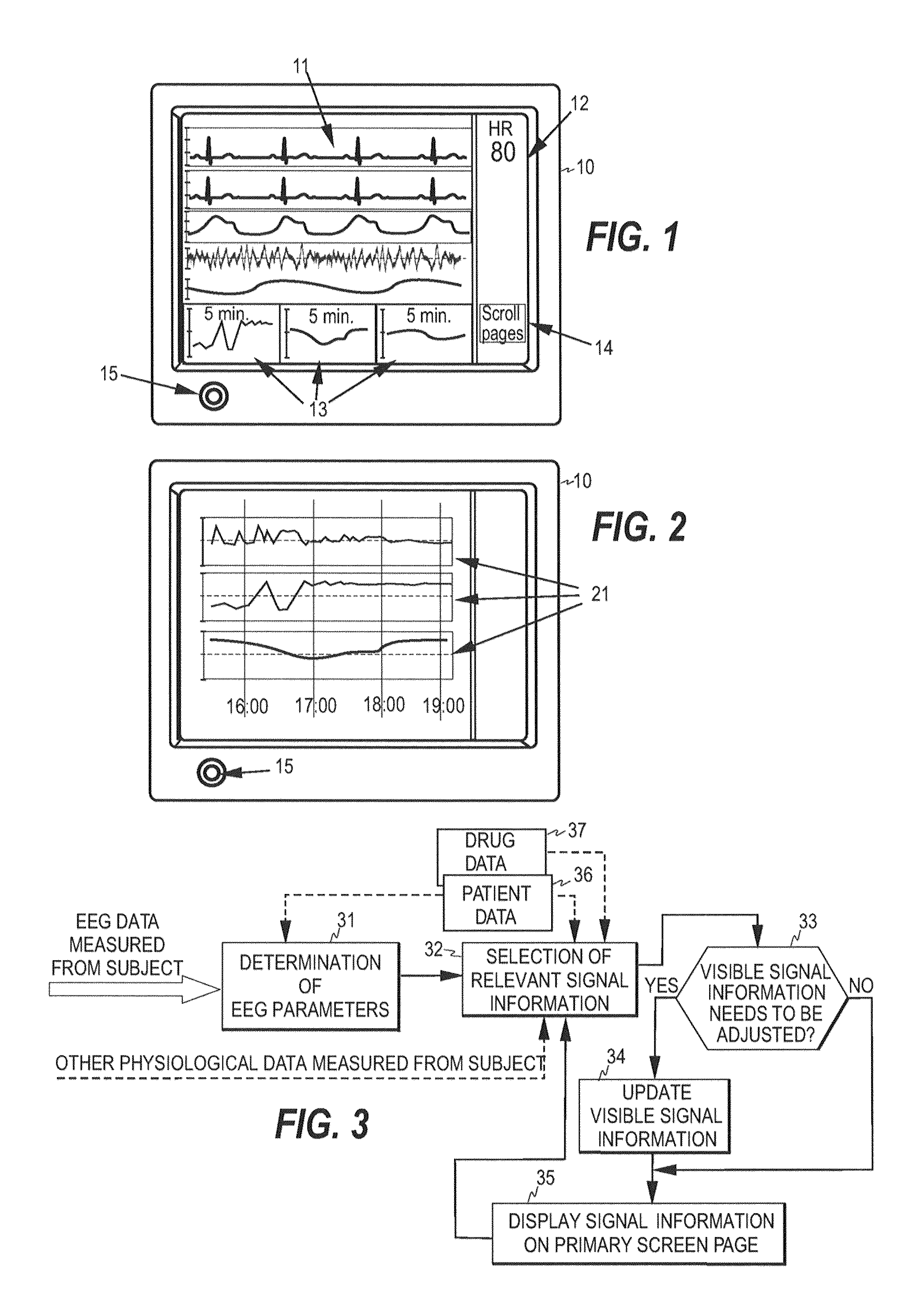 Method, device and computer product for EEG monitoring, analysis and display