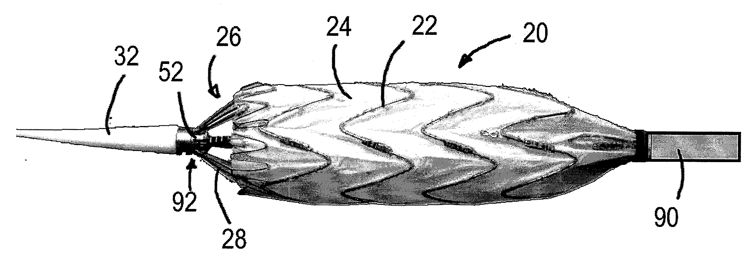 Stent Graft Delivery System and Method of Use