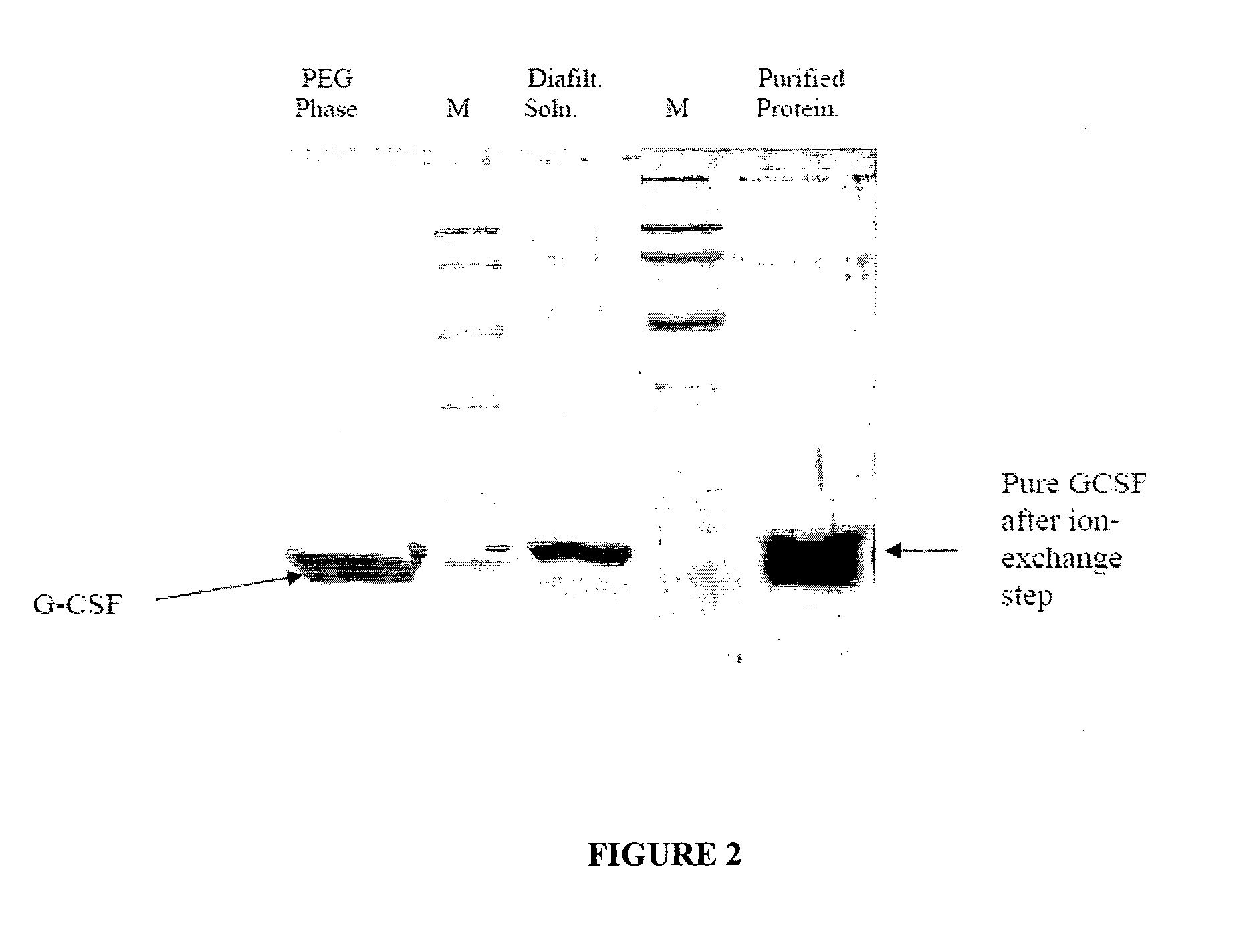 Process for purification of recombinant human granulocyte colony stimulating factor
