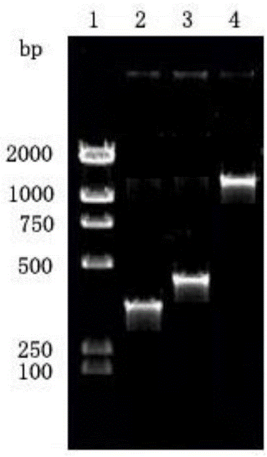 Treponema pallidum p15-17-47 fusion protein and recombination expression method thereof