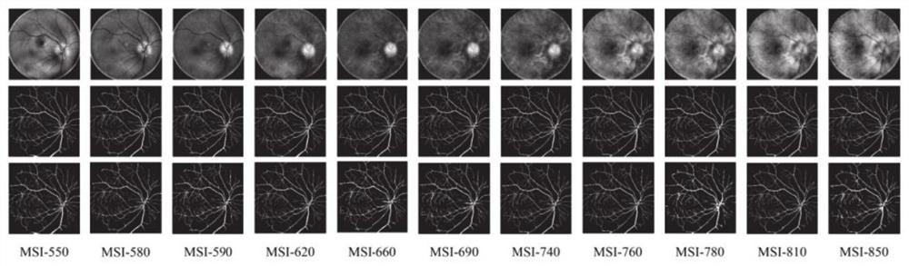 Multispectral fundus image analysis method and system based on adversarial learning