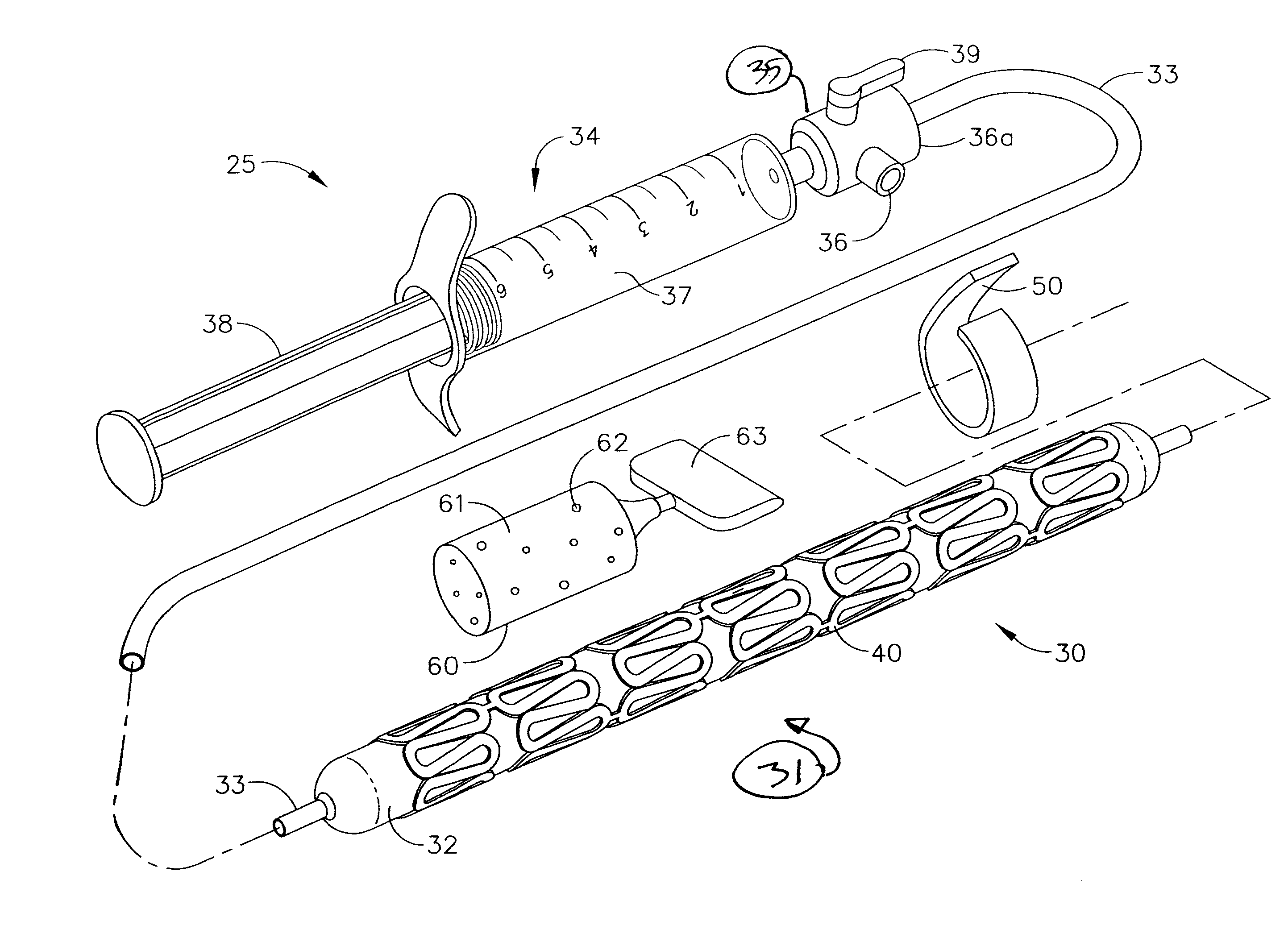 Method of Performing An End-to-End Anastomosis Using a Stent and an Adhesive