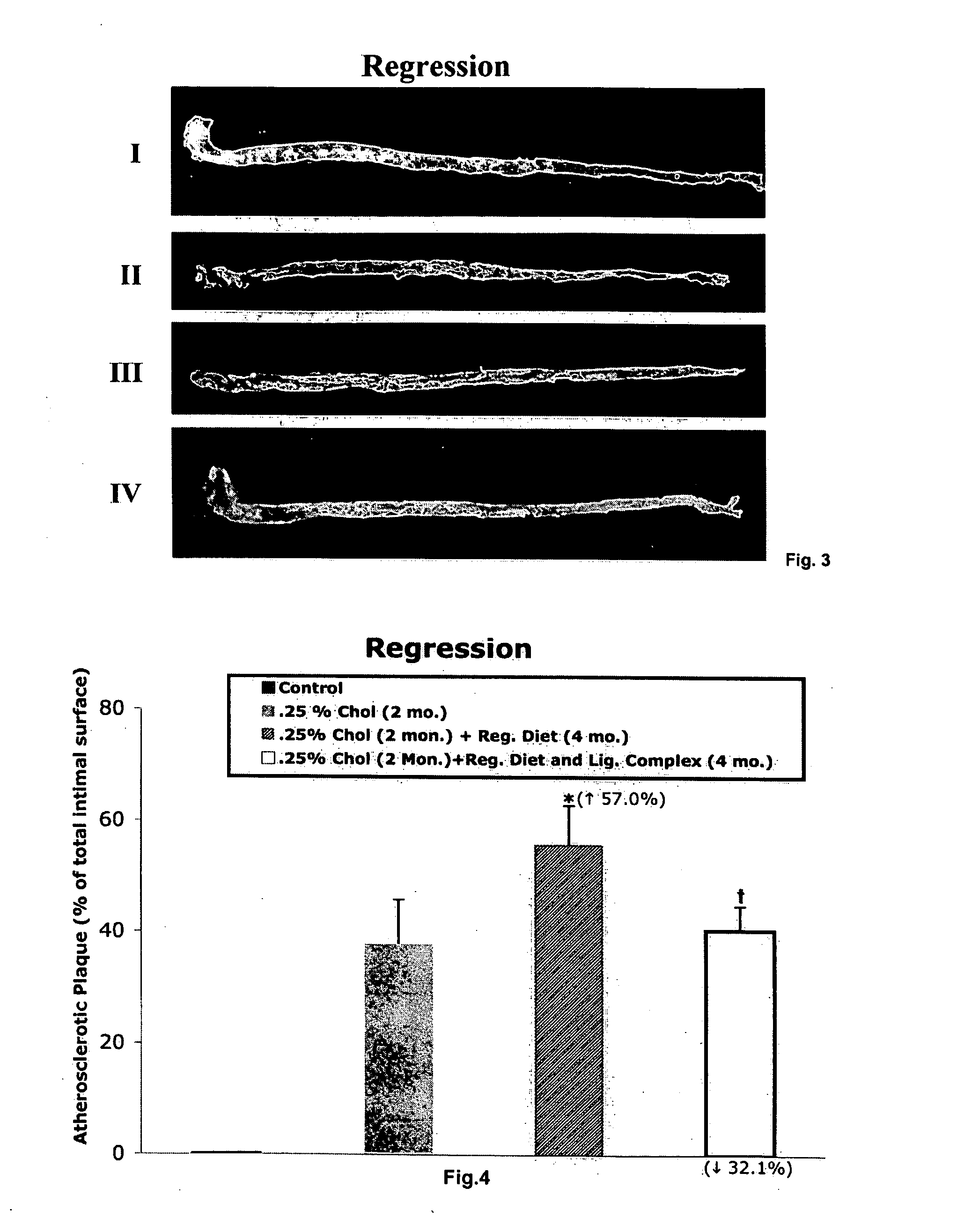 Lignan complex derived from flax seed used for treatment of hypercholesterolemic atherosclerosis