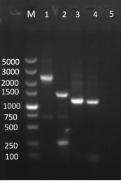 The ribosomal RNA gene and application of erysiphe alphitoides pathogenic tussah powdery mildew