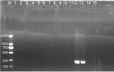 The ribosomal RNA gene and application of erysiphe alphitoides pathogenic tussah powdery mildew