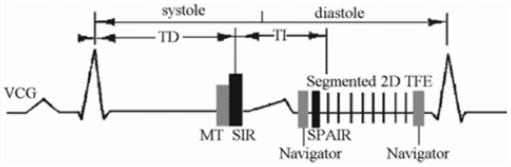 Magnetic resonance imaging method based on magnetization transfer combined with slice-selective inversion recovery pre-pulse