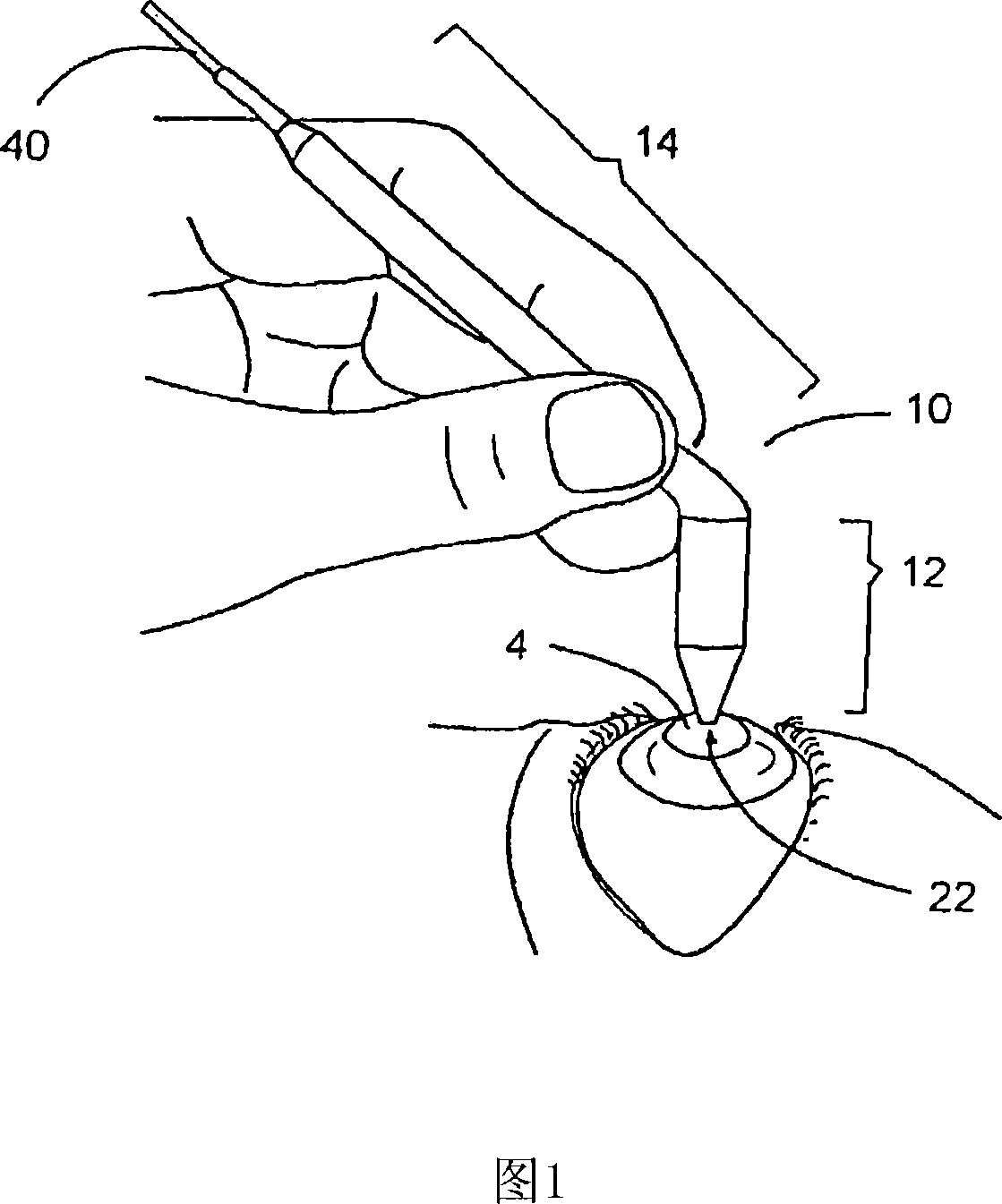 Improved apparatus and method of intraocular pressure determination