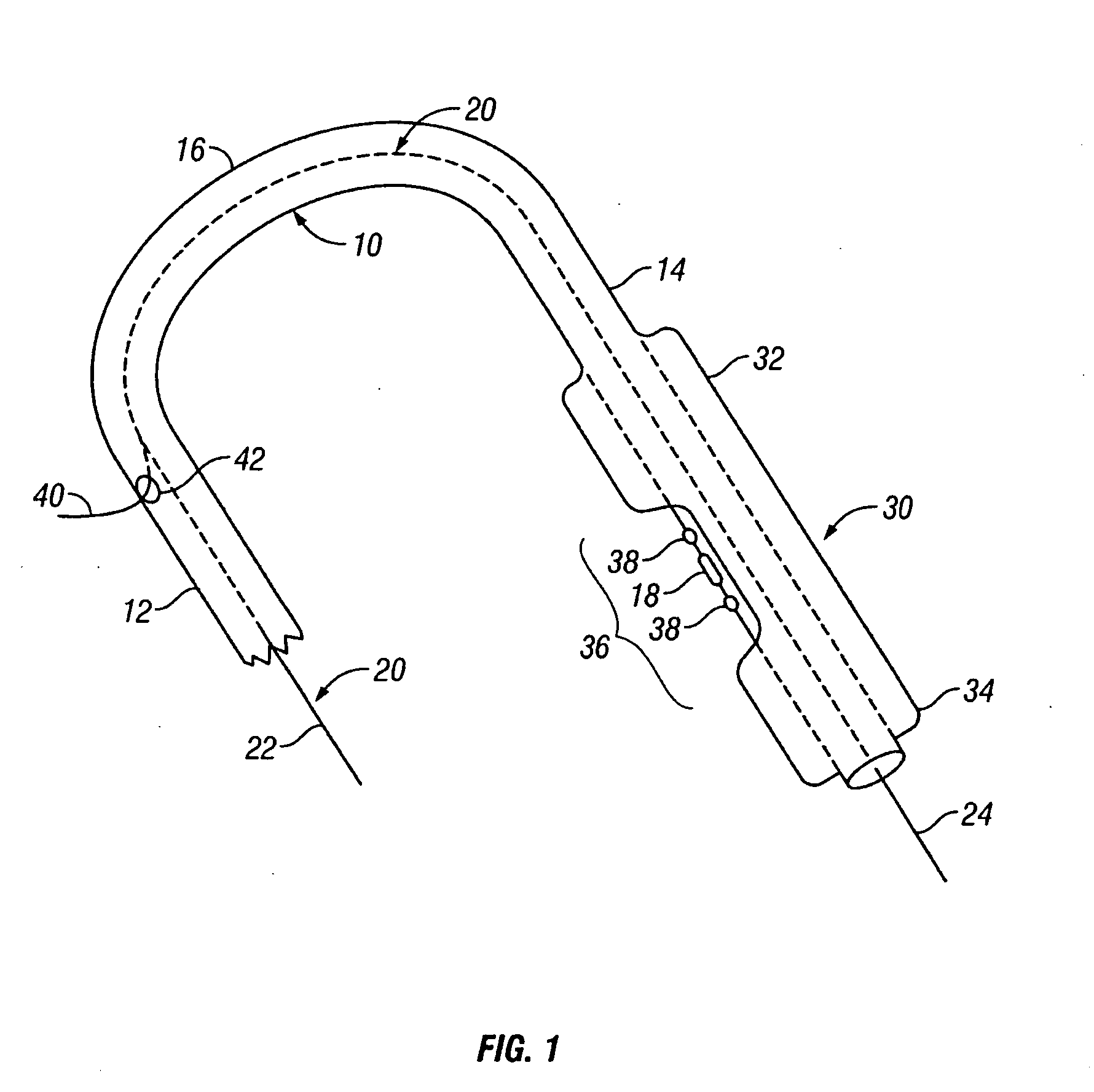 Bifurcation stent and delivery system