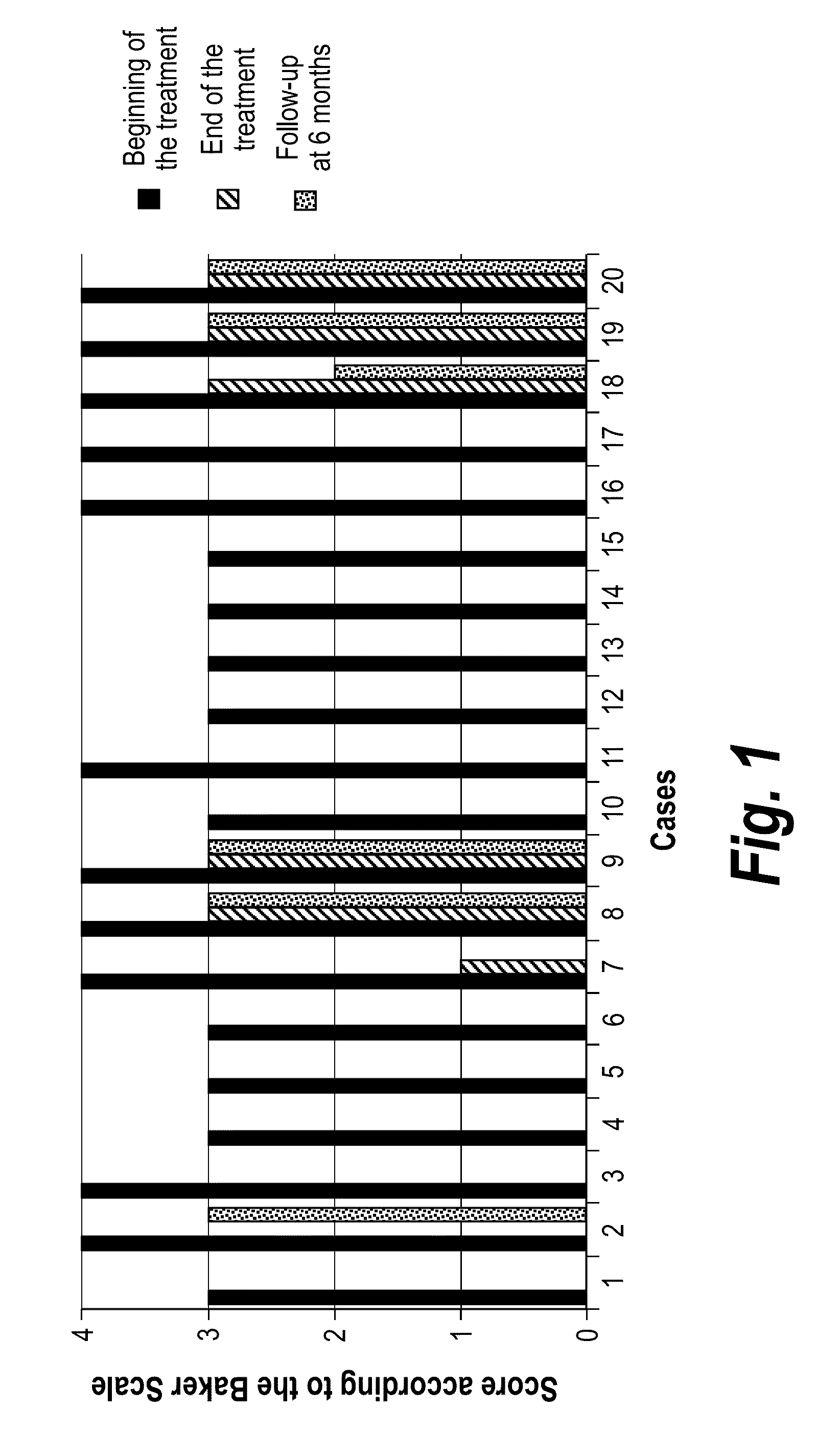 Pharmaceutical composition containing pirfenidone in sustained-release tablet form