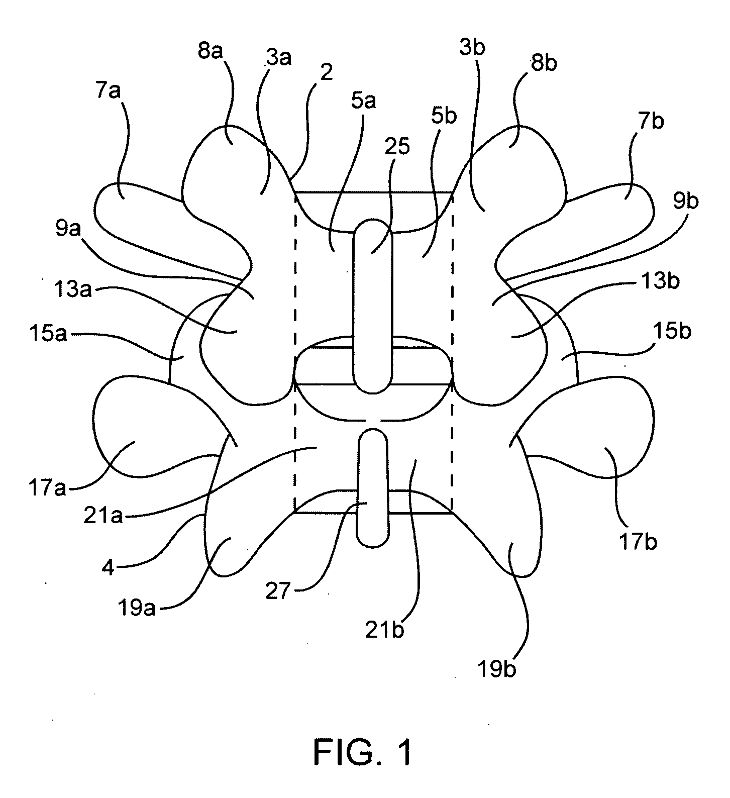 Systems and methods for posterior dynamic stabilization of the spine