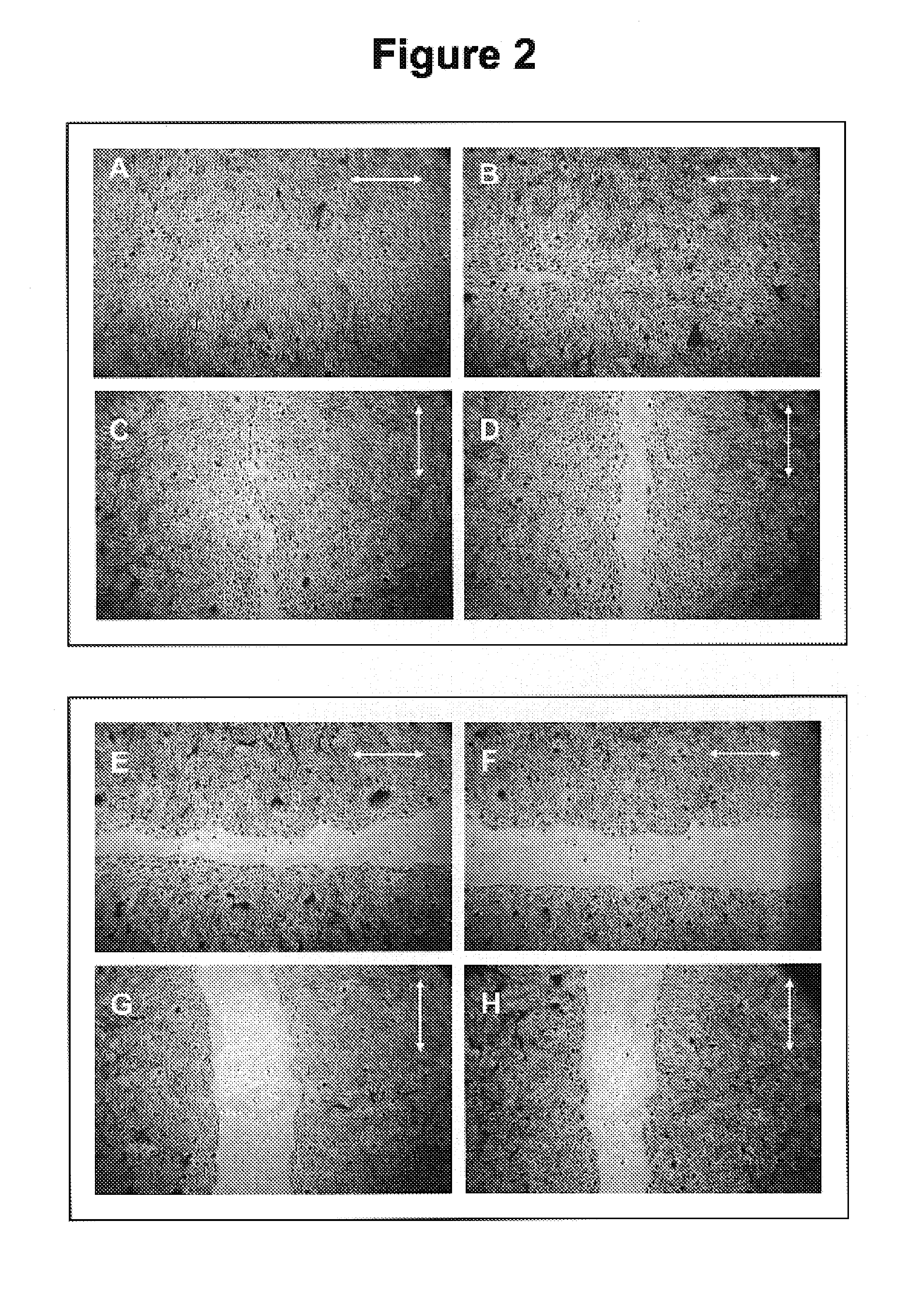 Methods for inhibiting cancer and scar formation