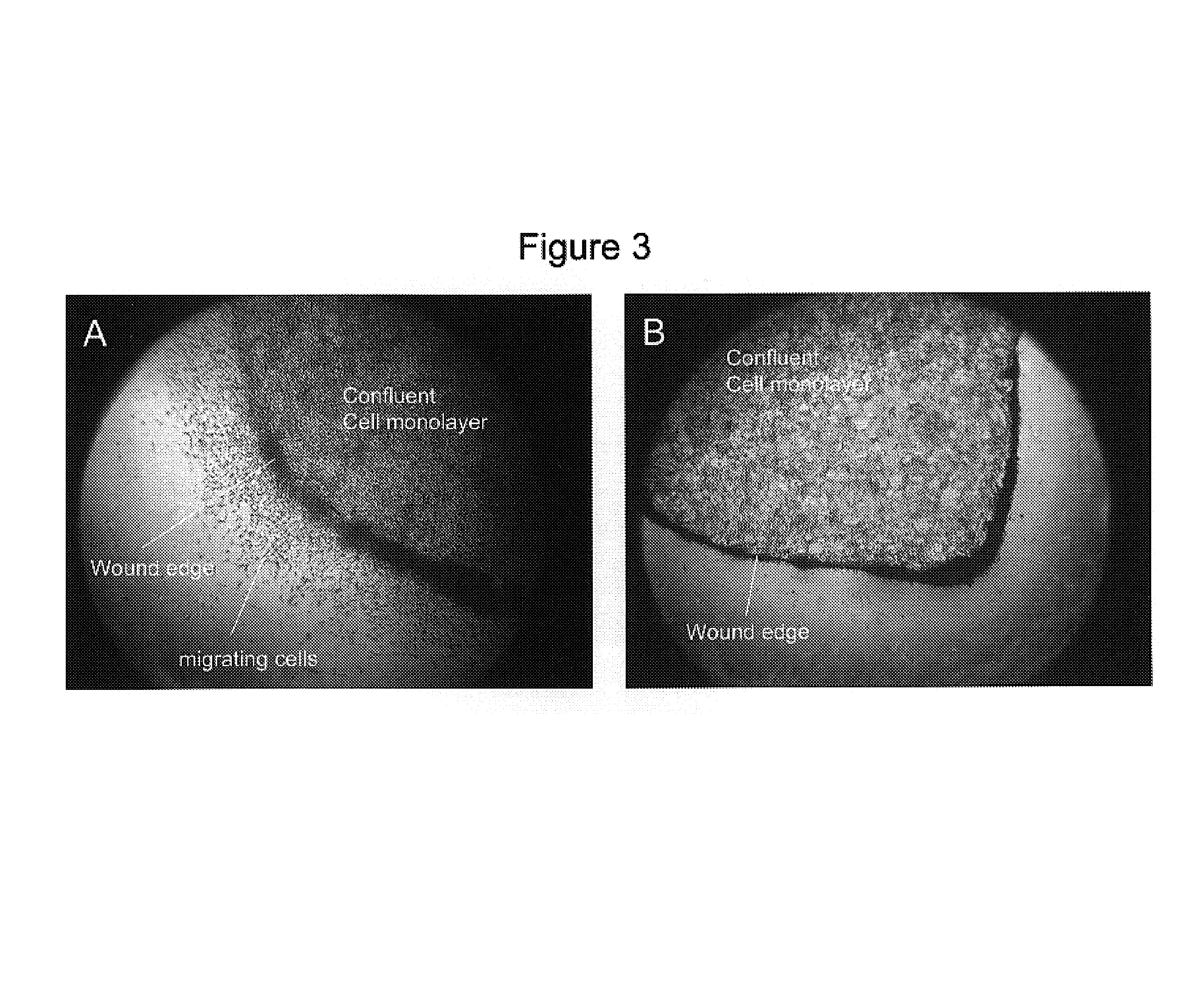 Methods for inhibiting cancer and scar formation