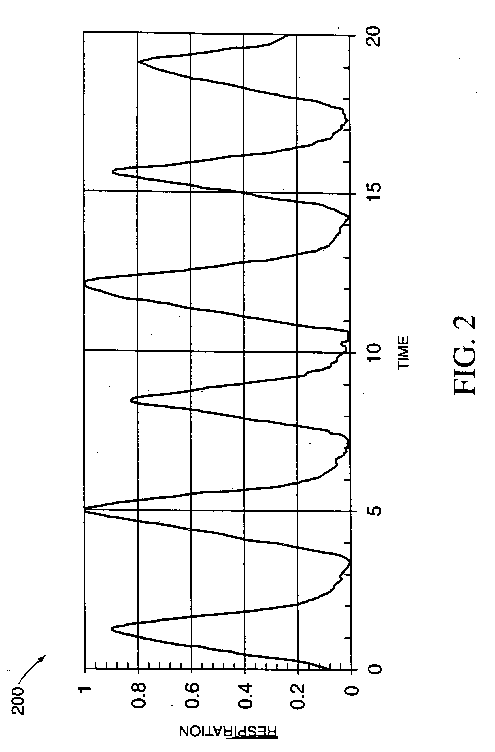 Method and system for predictive physiological gating