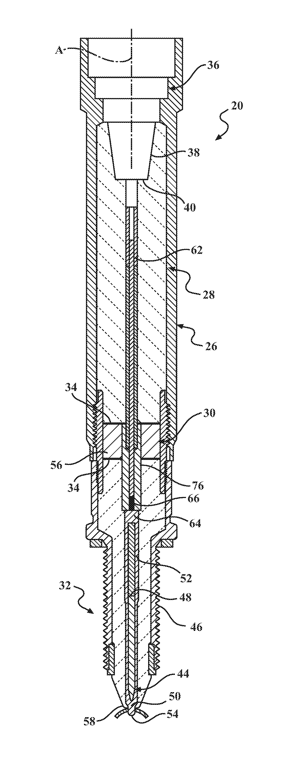 Corona suppression at the high voltage joint through introduction of a semi-conductive sleeve between the central electrode and the dissimilar insulating materials