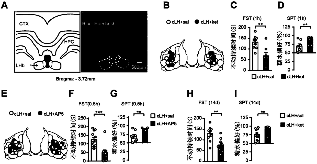 Regulation and use of T-type calcium channel inhibitor to depression