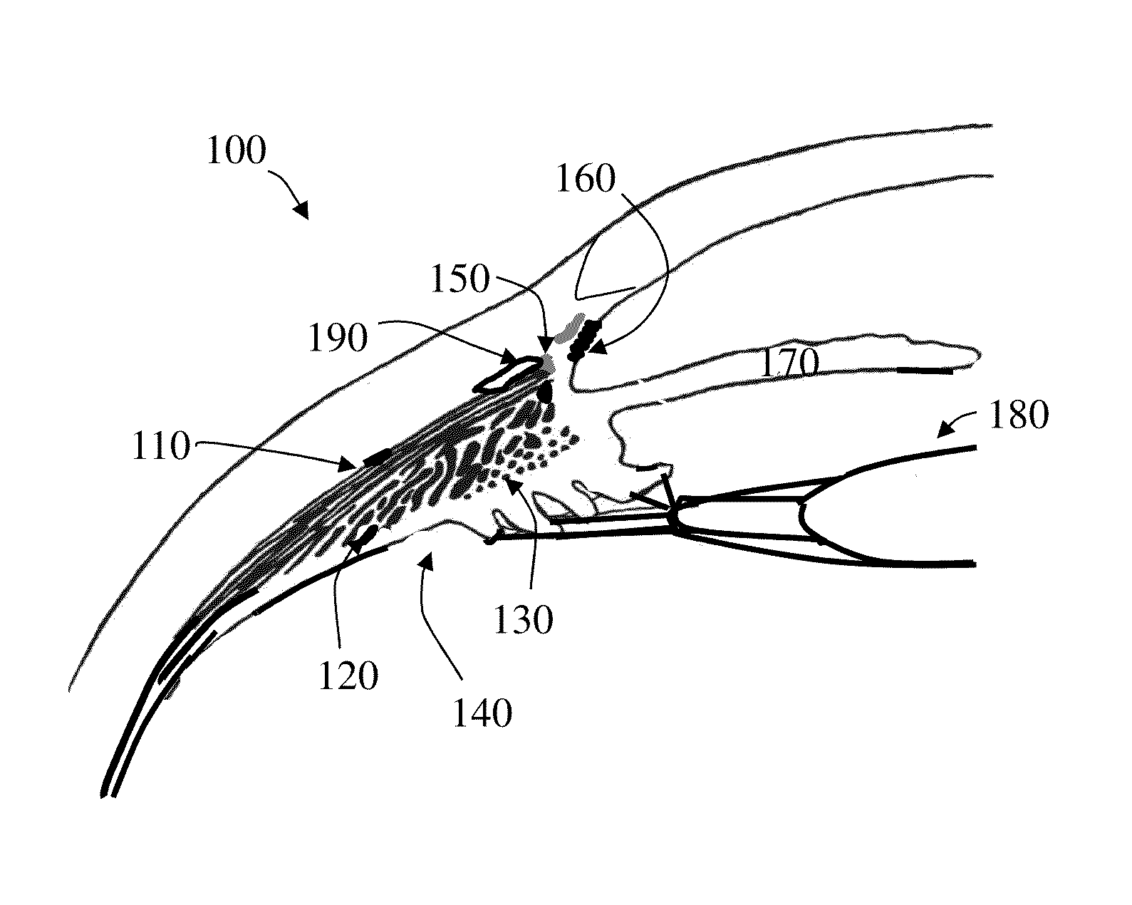 Presbyopia correcting wireless optical system