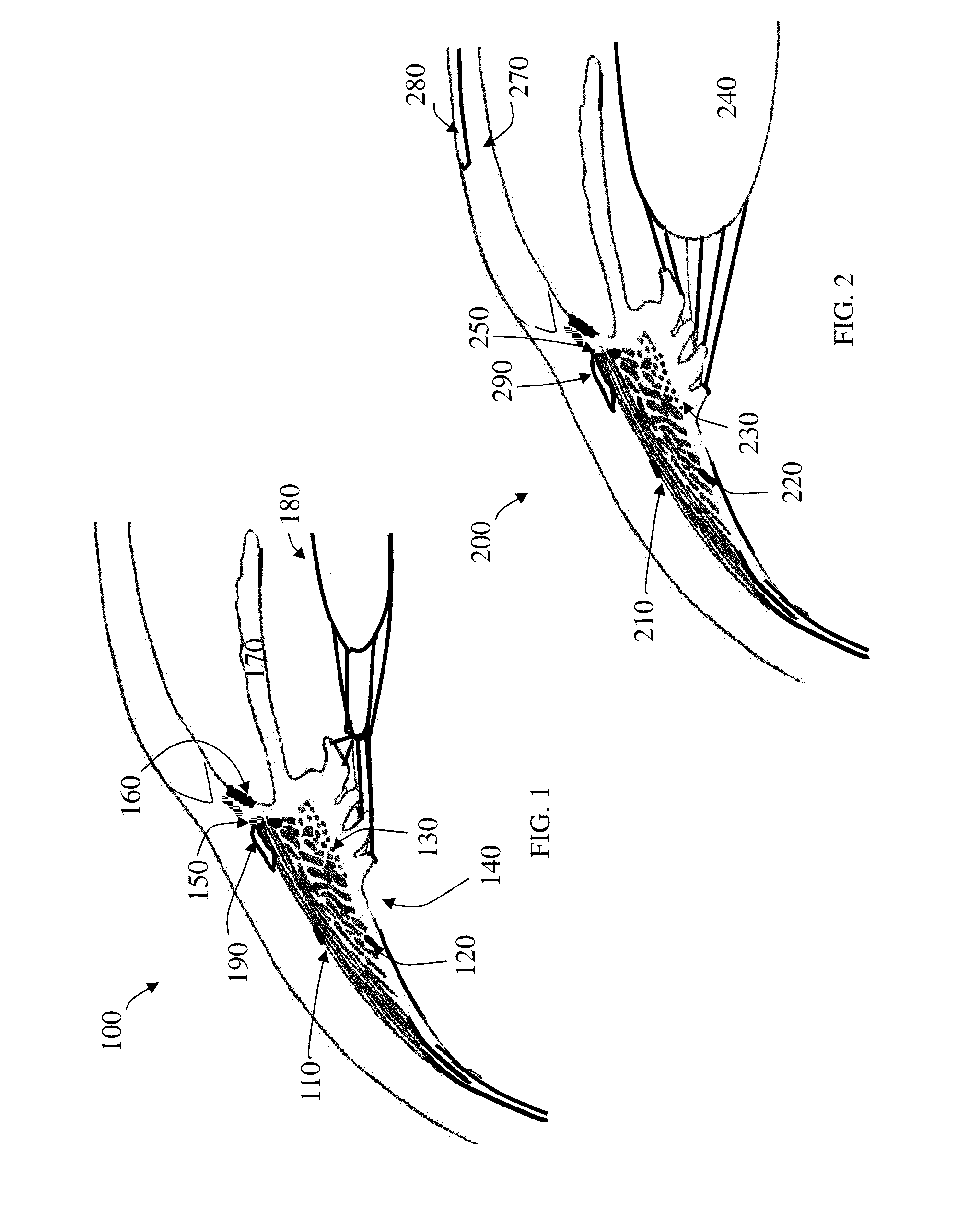 Presbyopia correcting wireless optical system