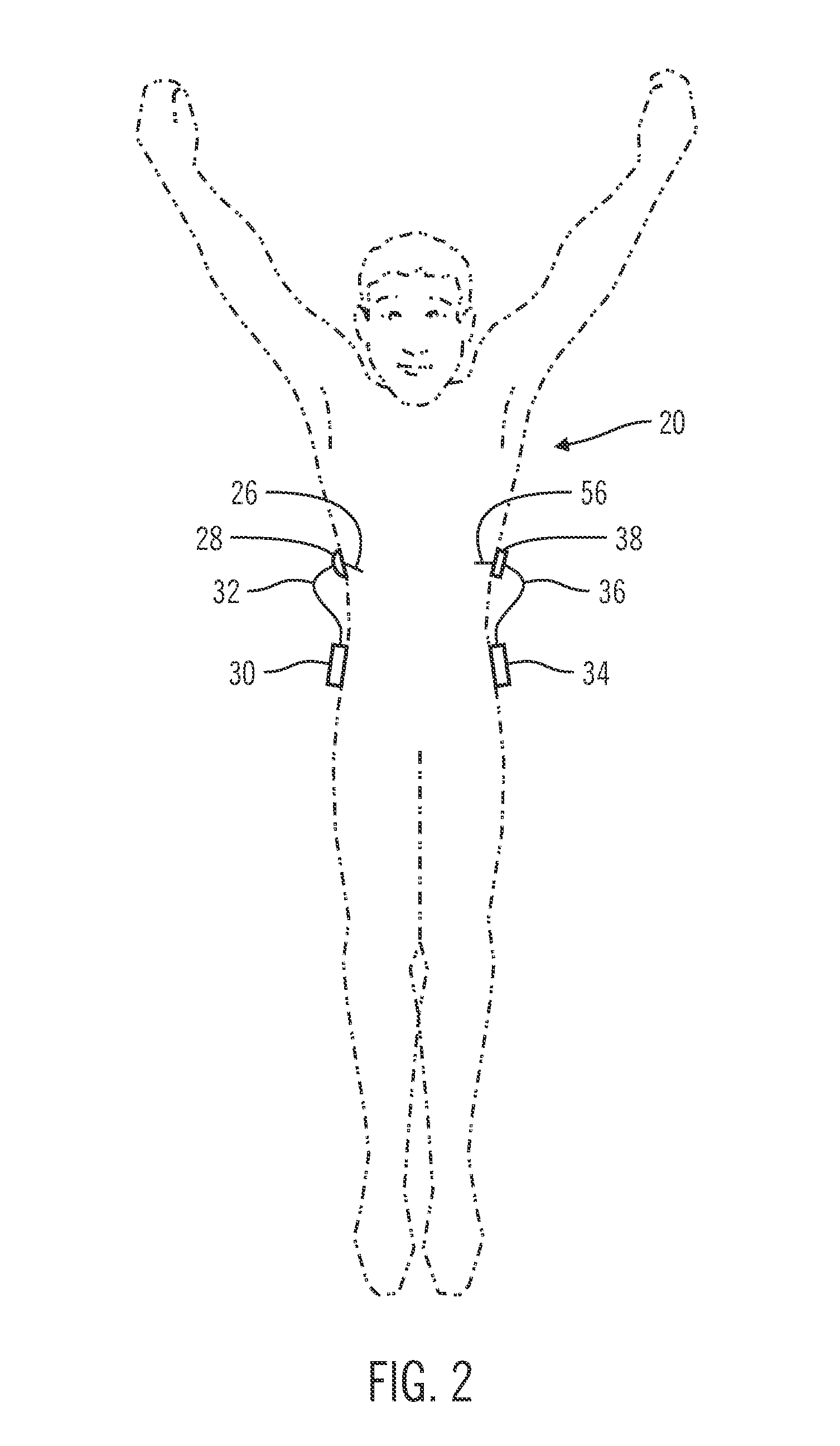 Generation of target glucose values for a closed-loop operating mode of an insulin infusion system