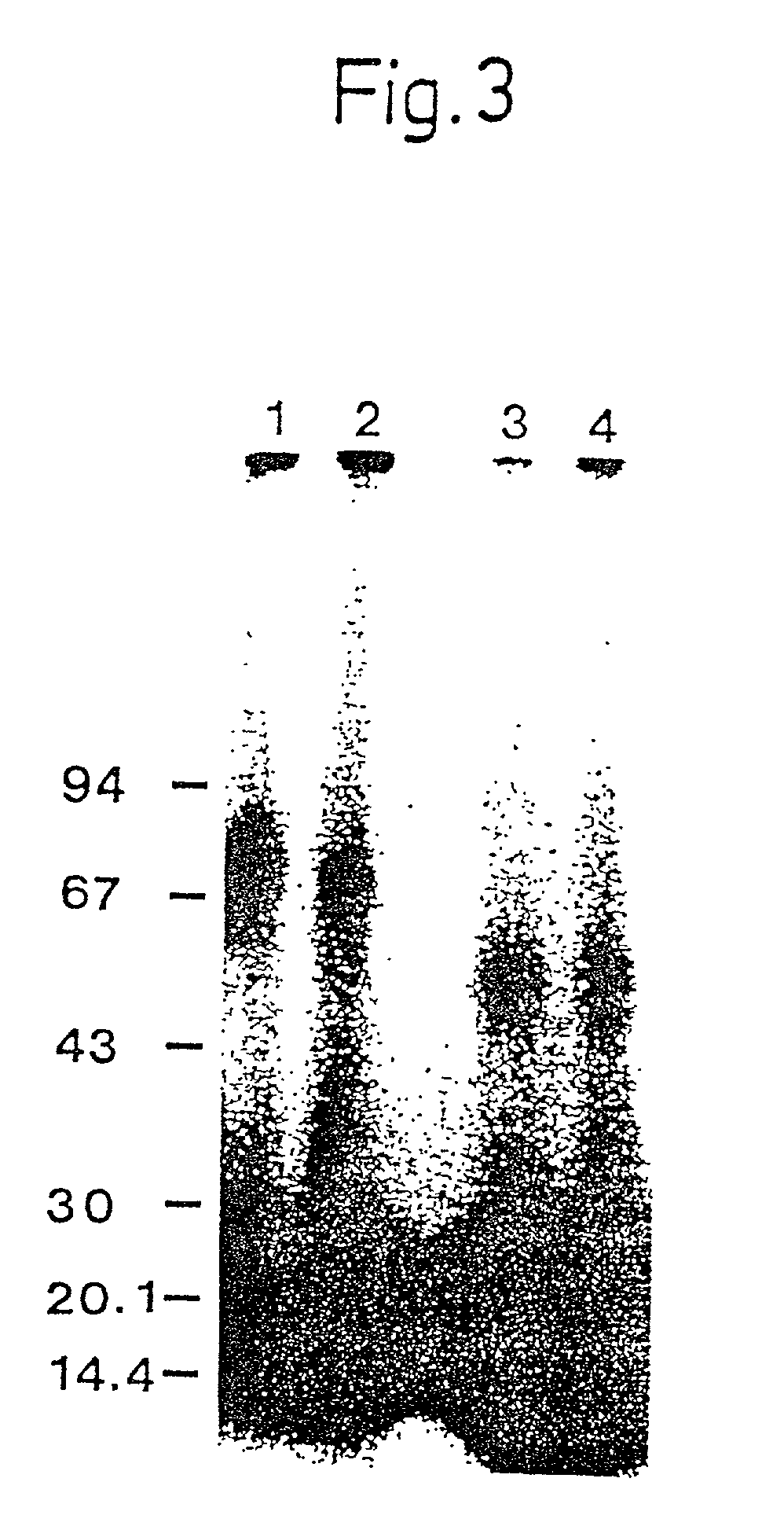 Urokinase-type plasminogen activator receptor