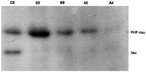 Tau resisting antibody and application thereof to treating Alzheimer disease and traumatic brain injury