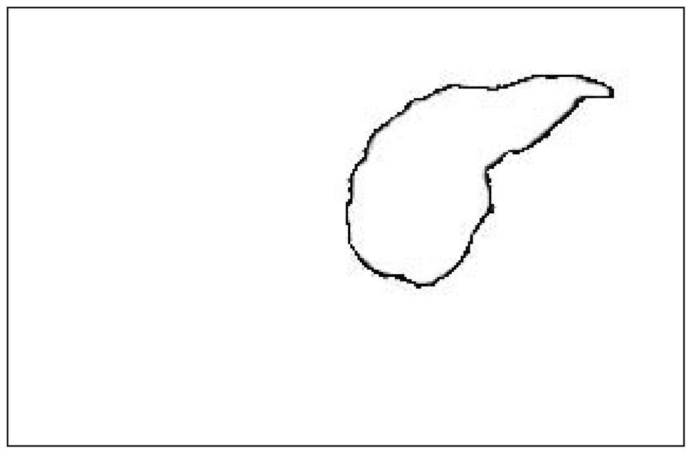 Gesture-based cursor movement method and device for medical display