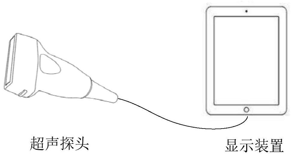 Follicle monitoring method, device, system and storage medium